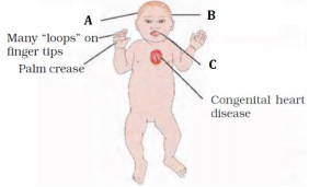 Principles Of Inheritance And Variation – NEET-5179